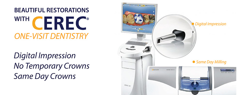 what is cerec crown made of