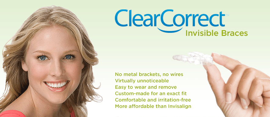 ClearCorrect Braces  How They Work & What They Cost