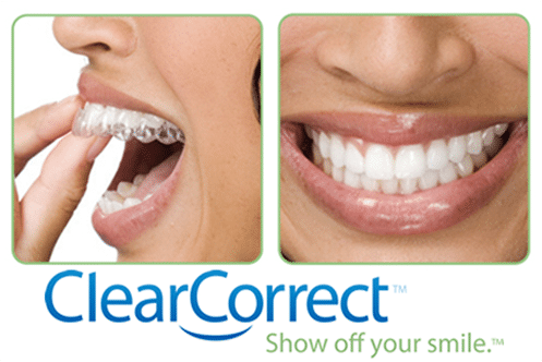 I want invisible braces. Is ClearCorrect the solution?