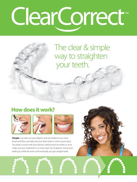 clearcorrect-invisible-braces