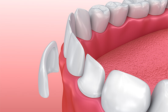 How Straight Teeth Do More than Improve Your Smile - Premier Dental