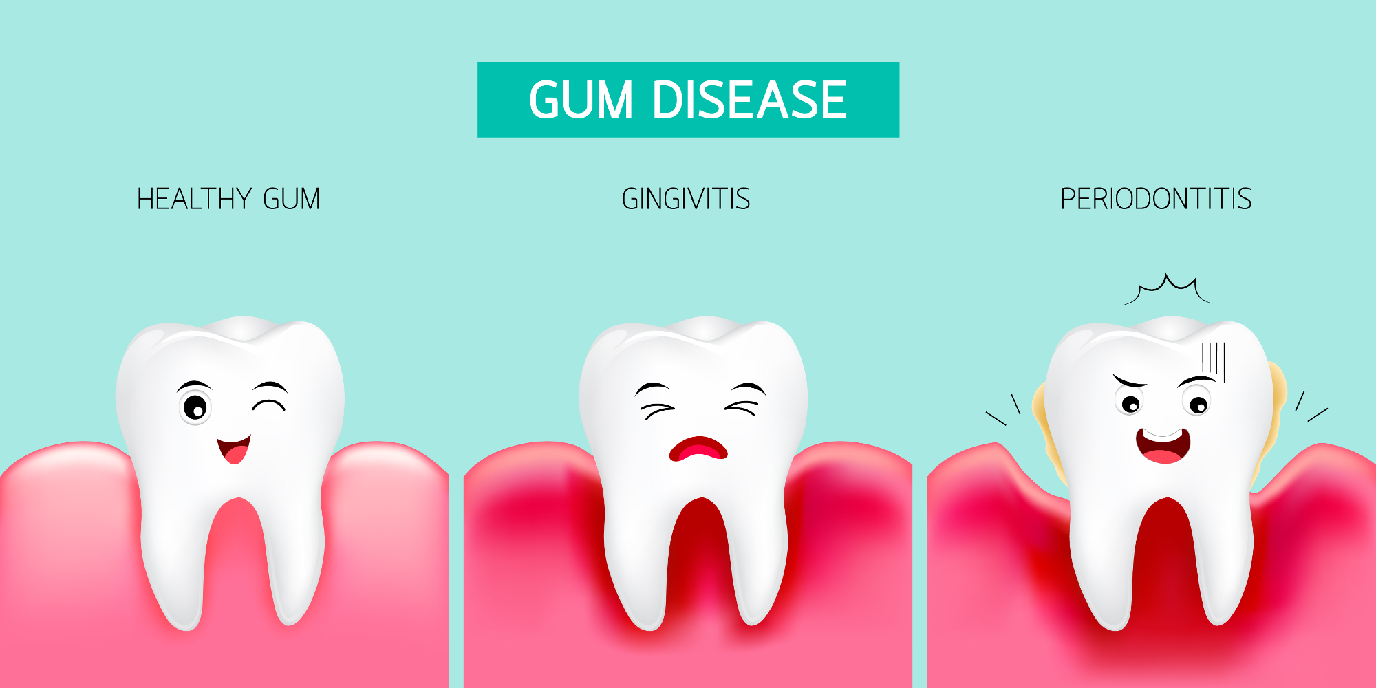 avoid-gum-disease