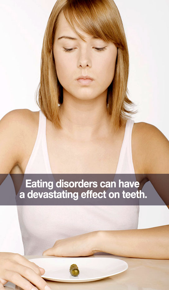 can-eating-disorders-hurt-my-teetht-my-teeth