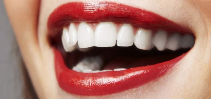 understanding-porcelain-veneers